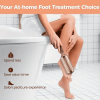 Foot File Foot Scrubber Pedicure - Foot Callus Remover Professional Grater Foot Scraper Corn Callus Remover Wet And Dry Foot Dead Skin Remover
